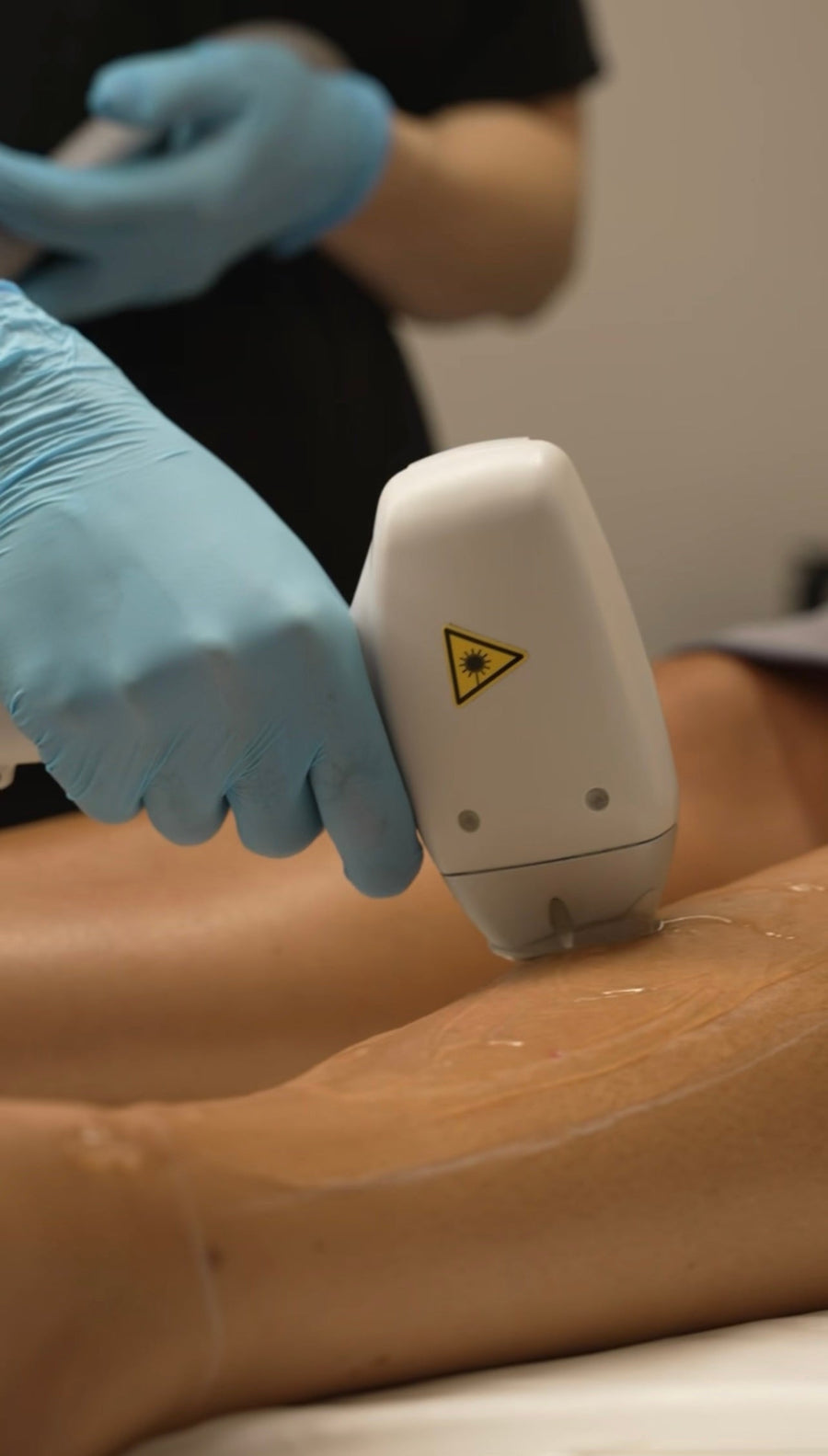 Épilation laser